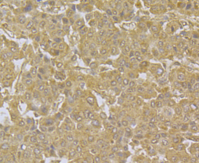 Immunohistochemical analysis of paraffin-embedded human liver tissue using anti-NDUFS3 antibody. Counter stained with hematoxylin.