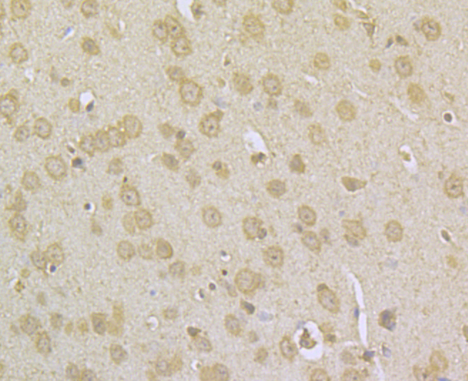 Immunohistochemical analysis of paraffin-embedded mouse brain tissue using anti-NDUFS3 antibody. Counter stained with hematoxylin.