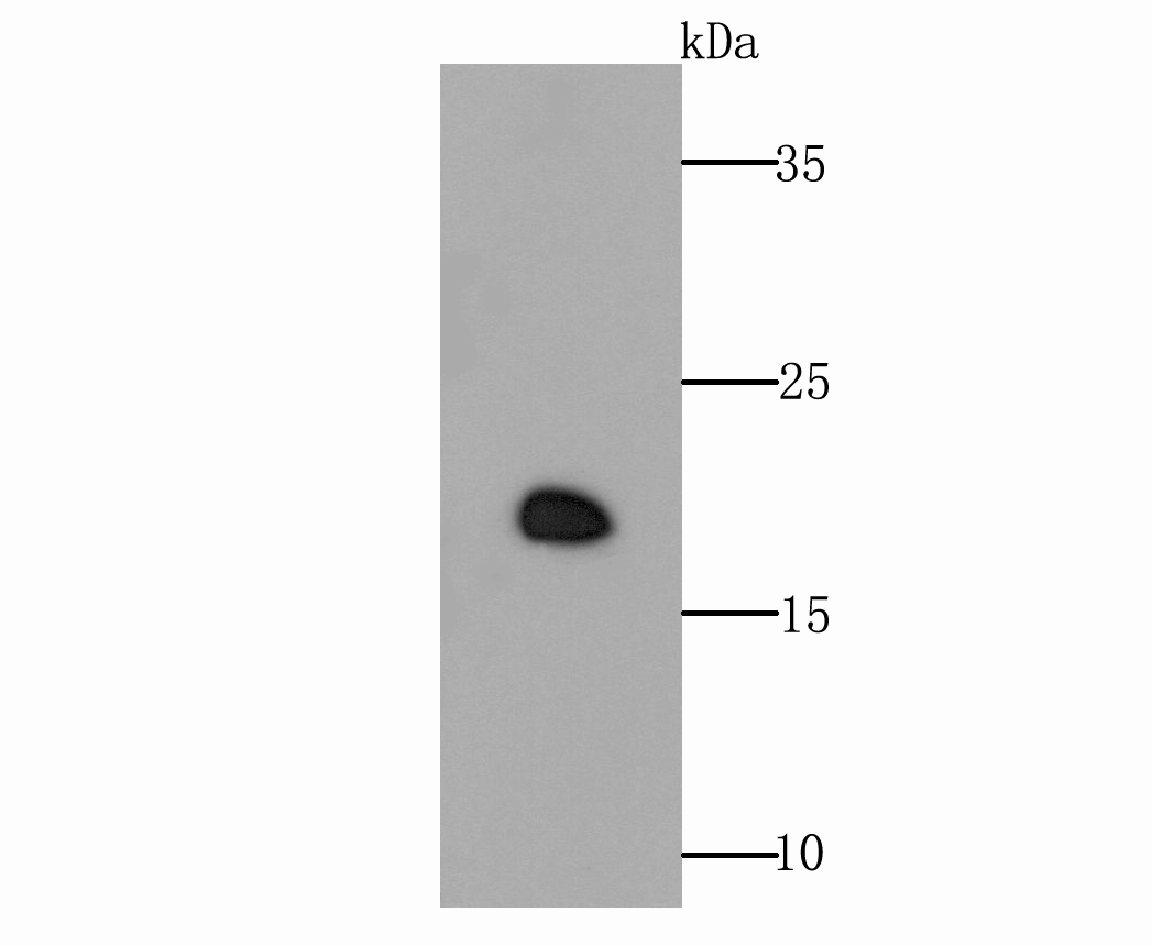 Western blot analysis of GPX4 on different lysates with Rabbit anti-GPX4 antibody (ER1803-15) at 1/1,000 dilution.<br />
<br />
Lane 1: Rat testis tissue lysate (20 µg/Lane)<br />
Lane 2: Mouse testis tissue lysate (20 µg/Lane)<br />
<br />
Predicted band size: 22 kDa<br />
Observed band size: 22 kDa<br />
<br />
Exposure time: 2 minutes;<br />
<br />
15% SDS-PAGE gel.<br />
<br />
Proteins were transferred to a PVDF membrane and blocked with 5% NFDM/TBST for 1 hour at room temperature. The primary antibody (ER1803-15) at 1/1,000 dilution was used in 5% NFDM/TBST at room temperature for 2 hours. Goat Anti-Rabbit IgG - HRP Secondary Antibody (HA1001) at 1:300,000 dilution was used for 1 hour at room temperature.