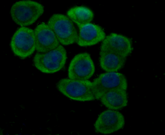 ICC staining GPX4 in LOVO cells (green). The nuclear counter stain is DAPI (blue). Cells were fixed in paraformaldehyde, permeabilised with 0.25% Triton X100/PBS.