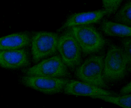 ICC staining WASL in SiHa cells (green). The nuclear counter stain is DAPI (blue). Cells were fixed in paraformaldehyde, permeabilised with 0.25% Triton X100/PBS.