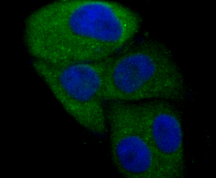 ICC staining WASL in SK-Br-3 cells (green). The nuclear counter stain is DAPI (blue). Cells were fixed in paraformaldehyde, permeabilised with 0.25% Triton X100/PBS.