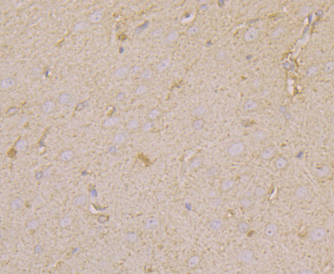 Immunohistochemical analysis of paraffin-embedded rat brain tissue using anti- WASL antibody. Counter stained with hematoxylin.