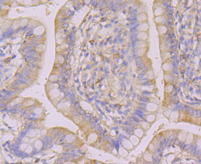 Immunohistochemical analysis of paraffin-embedded human small intestine tissue using anti- WASL antibody. Counter stained with hematoxylin.