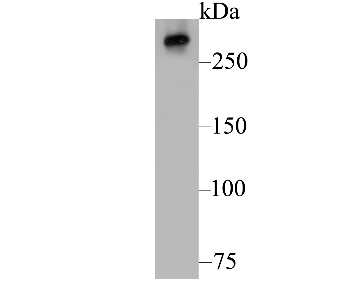 Western blot analysis of IP3 Receptor on Hela cell lysate using anti-IP3 Receptor antibody at 1/500 dilution.