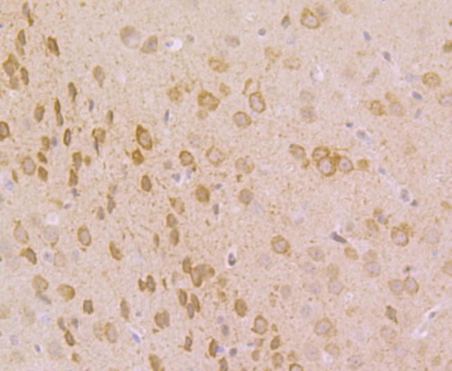Immunohistochemical analysis of paraffin-embedded mouse brain tissue using anti-IP3 Receptor antibody. Counter stained with hematoxylin.