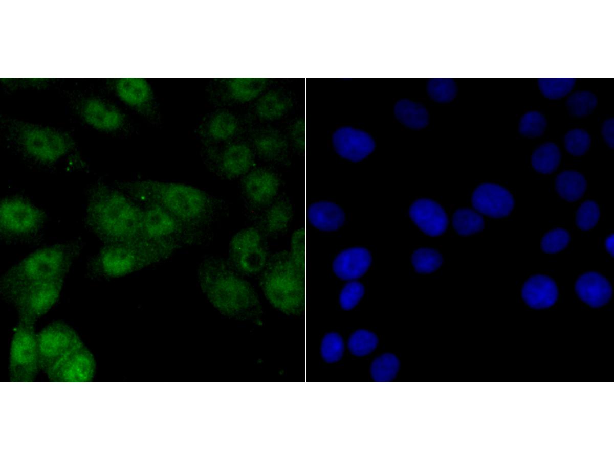 ICC staining Vitamin D Receptor in LOVO cells (green). The nuclear counter stain is DAPI (blue). Cells were fixed in paraformaldehyde, permeabilised with 0.25% Triton X100/PBS.