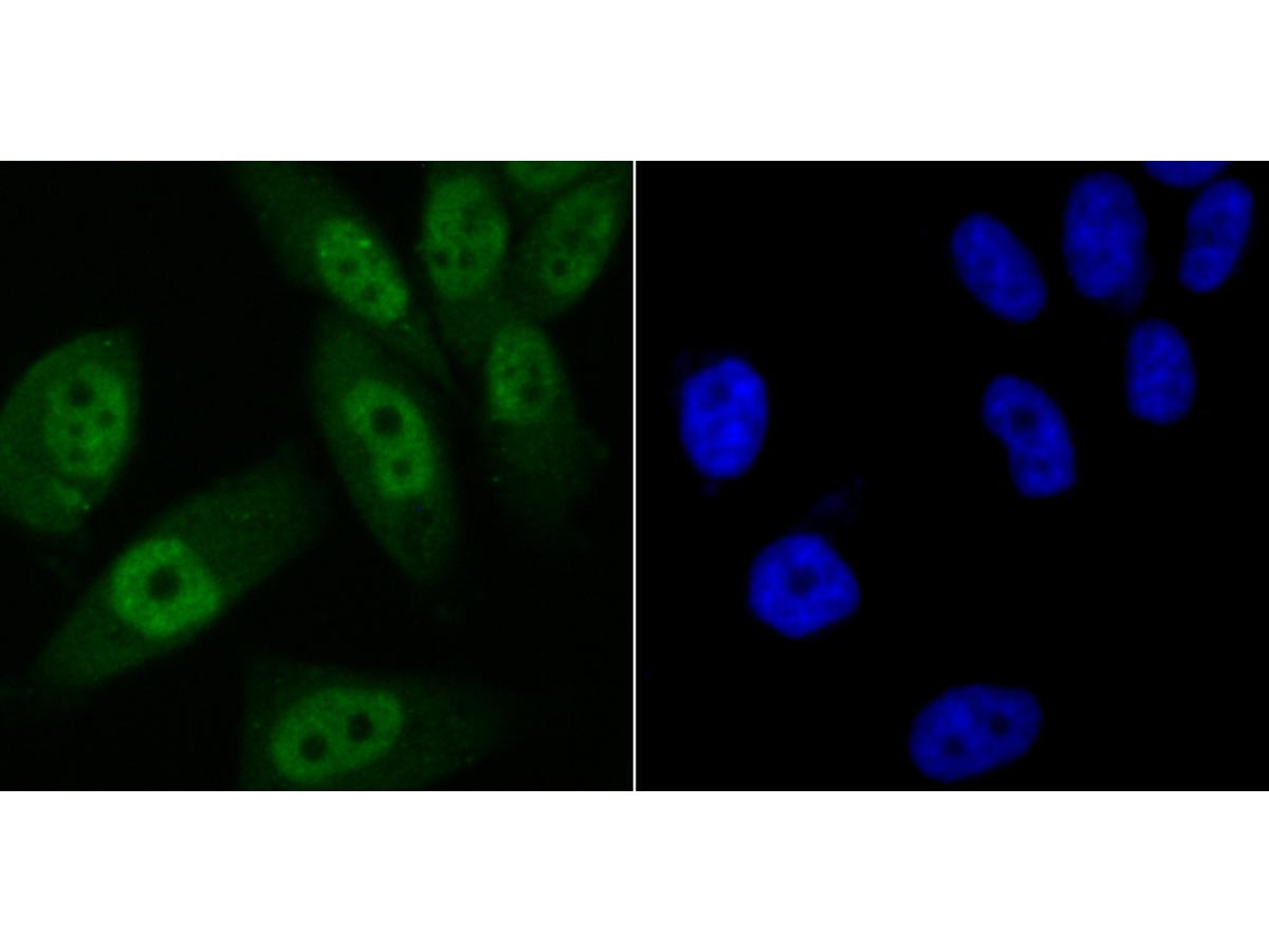 ICC staining Vitamin D Receptor in PC-3M cells (green). The nuclear counter stain is DAPI (blue). Cells were fixed in paraformaldehyde, permeabilised with 0.25% Triton X100/PBS.