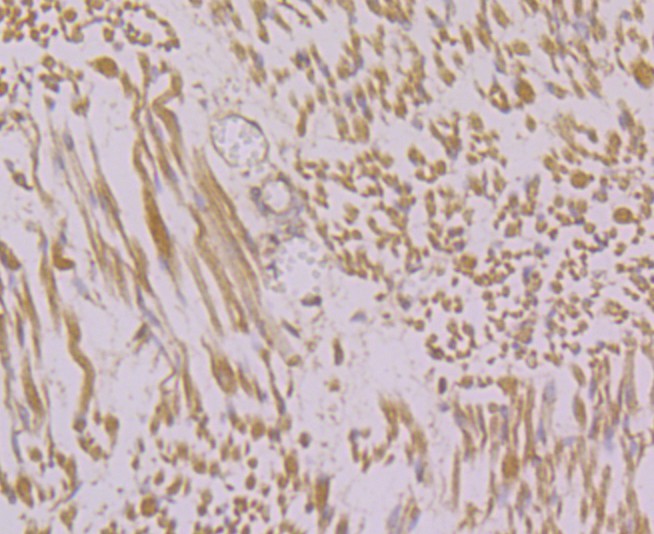 Immunohistochemical analysis of paraffin-embedded human fetal skeletal muscle tissue using anti-RYR1 antibody. Counter stained with hematoxylin.