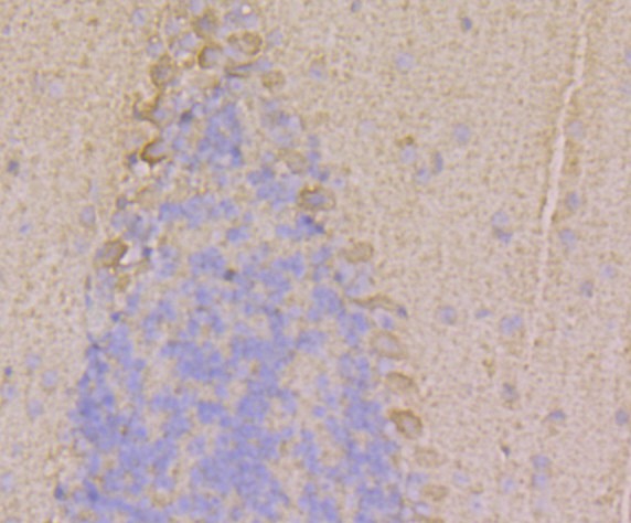 Immunohistochemical analysis of paraffin-embedded mouse cerebellum tissue using anti-RYR1 antibody. Counter stained with hematoxylin.