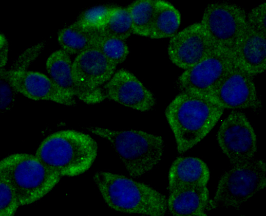 ICC staining RYR2 in LOVO cells (green). The nuclear counter stain is DAPI (blue). Cells were fixed in paraformaldehyde, permeabilised with 0.25% Triton X100/PBS.