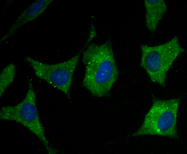 ICC staining RYR2 in SH-SY-5Y cells (green). The nuclear counter stain is DAPI (blue). Cells were fixed in paraformaldehyde, permeabilised with 0.25% Triton X100/PBS.