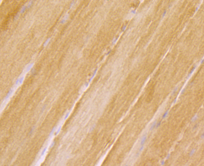 Immunohistochemical analysis of paraffin-embedded rat skeletal muscle tissue using anti-RYR2 antibody. Counter stained with hematoxylin.