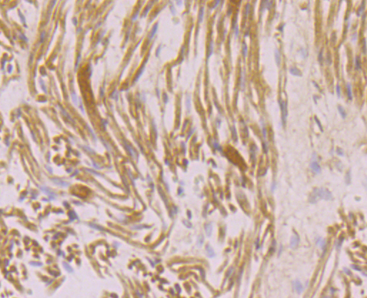 Immunohistochemical analysis of paraffin-embedded human fetal skeletal muscle tissue using anti-RYR2 antibody. Counter stained with hematoxylin.