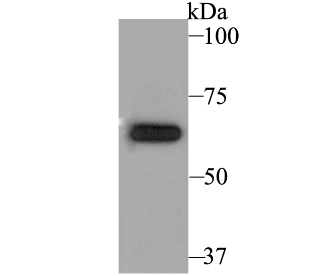 Western blot analysis of KCNA5 on different lysates with Rabbit anti-KCNA5 antibody (ER1803-23) at 1/500 dilution.<br />
<br />
Lane 1: PANC-1 cell lysate<br />
Lane 2: Mouse pancreatic tissue lysate (20 µg/Lane)<br />
<br />
Lysates/proteins at 10 µg/Lane.<br />
<br />
Predicted band size: 67 kDa<br />
Observed band size: 67 kDa<br />
<br />
Exposure time: 2 minutes;<br />
<br />
8% SDS-PAGE gel.<br />
<br />
Proteins were transferred to a PVDF membrane and blocked with 5% NFDM/TBST for 1 hour at room temperature. The primary antibody (ER1803-23) at 1/500 dilution was used in 5% NFDM/TBST at room temperature for 2 hours. Goat Anti-Rabbit IgG - HRP Secondary Antibody (HA1001) at 1:300,000 dilution was used for 1 hour at room temperature.