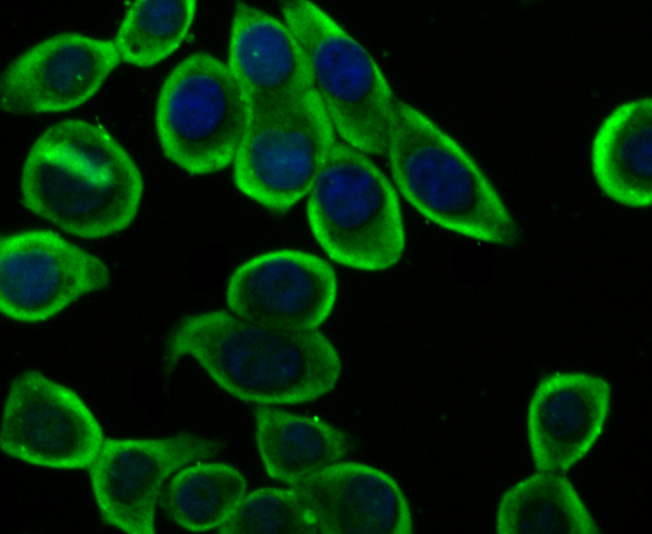 ICC staining KCNA5 in LOVO cells (green). The nuclear counter stain is DAPI (blue). Cells were fixed in paraformaldehyde, permeabilised with 0.25% Triton X100/PBS.