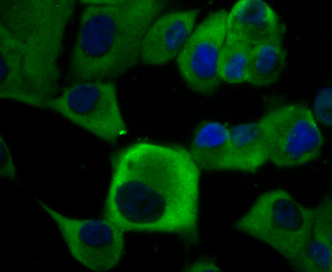 ICC staining KCNA5 in PANC-1 cells (green). The nuclear counter stain is DAPI (blue). Cells were fixed in paraformaldehyde, permeabilised with 0.25% Triton X100/PBS.
