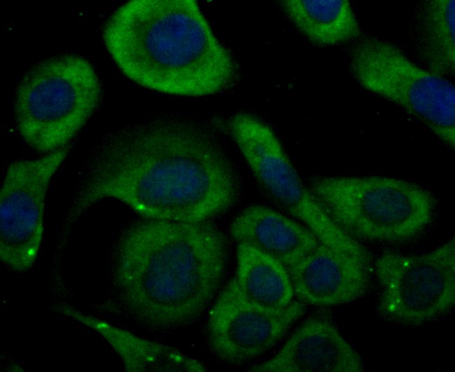 ICC staining KCNA5 in SKOV-3 cells (green). The nuclear counter stain is DAPI (blue). Cells were fixed in paraformaldehyde, permeabilised with 0.25% Triton X100/PBS.