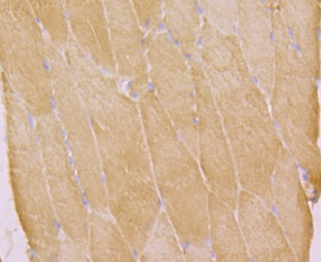 Immunohistochemical analysis of paraffin-embedded rat skeletal muscle tissue using anti-KCNA5 antibody. Counter stained with hematoxylin.