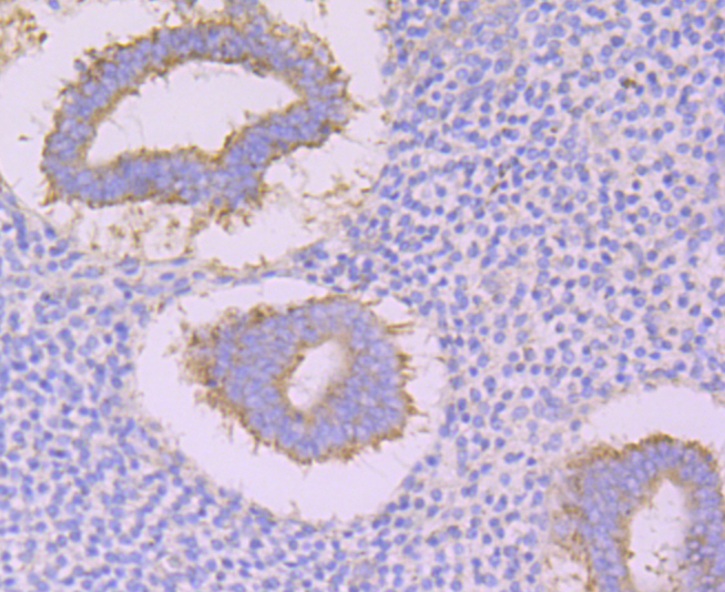 Immunohistochemical analysis of paraffin-embedded human uterus tissue using anti-CACNB3 antibody. Counter stained with hematoxylin.