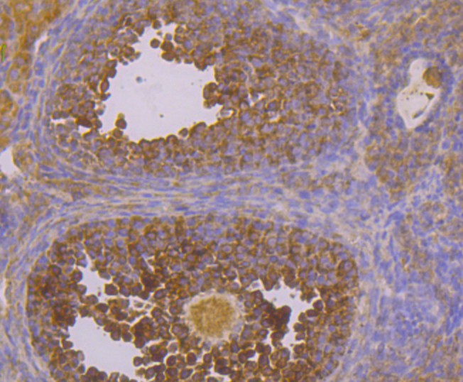 Immunohistochemical analysis of paraffin-embedded mouse ovary tissue using anti-CACNB3 antibody. Counter stained with hematoxylin.