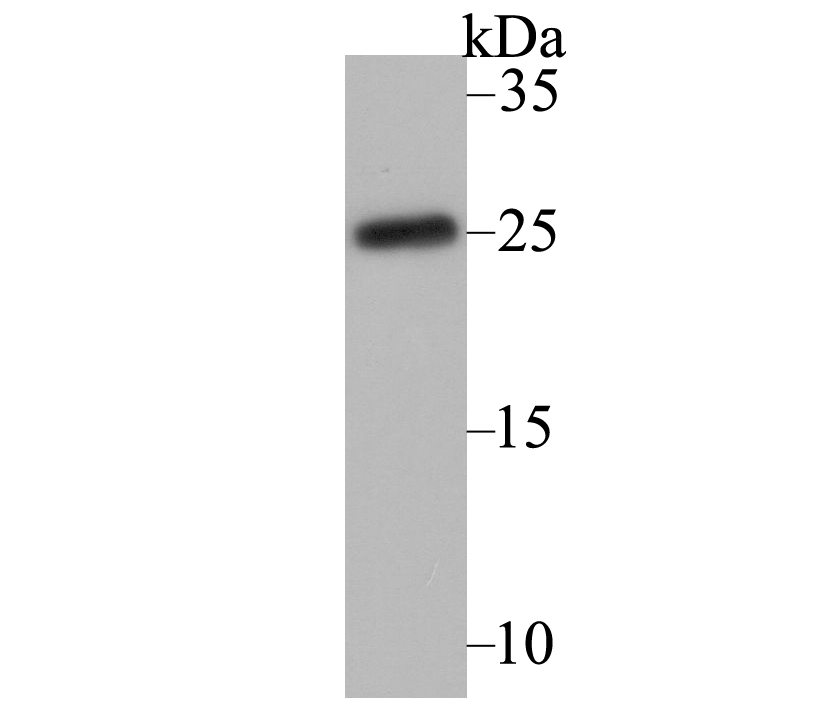 Western blot analysis of CACNG1 on human skeletal muscle lysate using anti-CACNG1 antibody at 1/1,000 dilution.