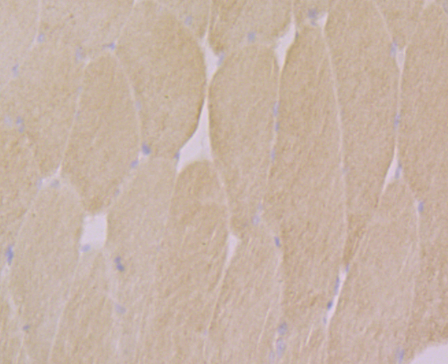 Immunohistochemical analysis of paraffin-embedded rat skeletal muscle tissue using anti-CACNG1 antibody. Counter stained with hematoxylin.
