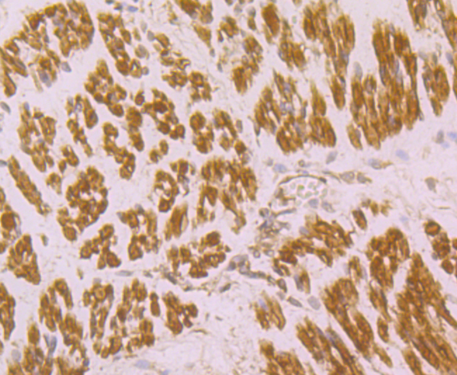 Immunohistochemical analysis of paraffin-embedded human fetal skeletal muscle tissue using anti-CACNG1 antibody. Counter stained with hematoxylin.