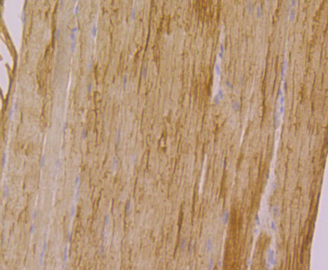 Immunohistochemical analysis of paraffin-embedded mouse skeletal muscle tissue using anti-CACNG1 antibody. Counter stained with hematoxylin.