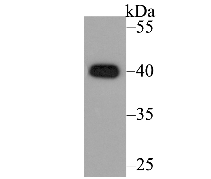 Western blot analysis of CACNG5 on LOVO cell lysate using anti-CACNG5 antibody at 1/200 dilution.