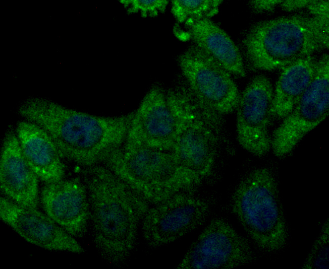 ICC staining CACNG5 in HepG2 cells (green). The nuclear counter stain is DAPI (blue). Cells were fixed in paraformaldehyde, permeabilised with 0.25% Triton X100/PBS.