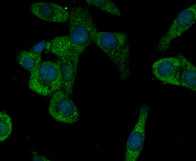 ICC staining CACNG5 in LOVO cells (green). The nuclear counter stain is DAPI (blue). Cells were fixed in paraformaldehyde, permeabilised with 0.25% Triton X100/PBS.