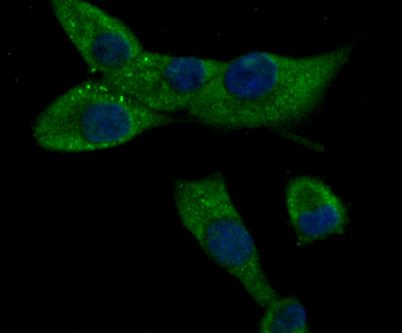 ICC staining CACNG5 in PANC-1 cells (green). The nuclear counter stain is DAPI (blue). Cells were fixed in paraformaldehyde, permeabilised with 0.25% Triton X100/PBS.