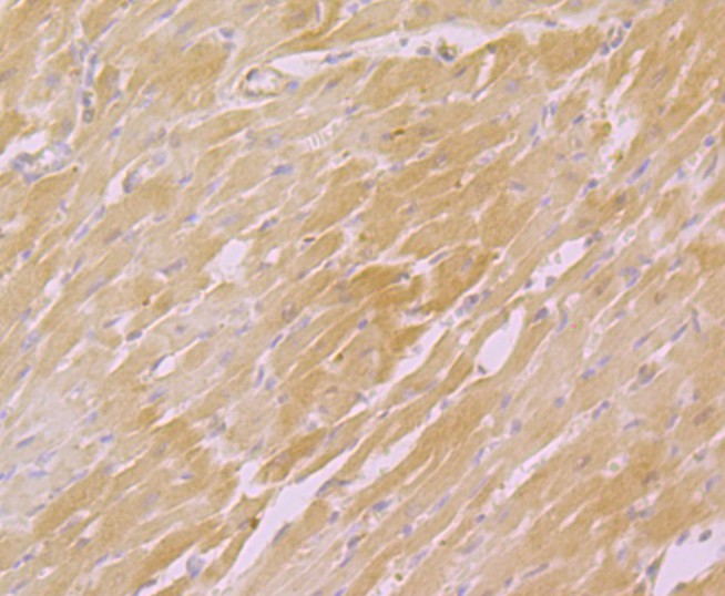 Immunohistochemical analysis of paraffin-embedded rat heart tissue using anti-CACNB1 antibody. Counter stained with hematoxylin.