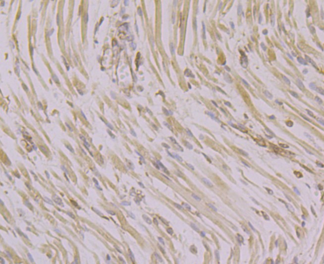 Immunohistochemical analysis of paraffin-embedded human fetal skeletal muscle tissue using anti-CACNB1 antibody. Counter stained with hematoxylin.