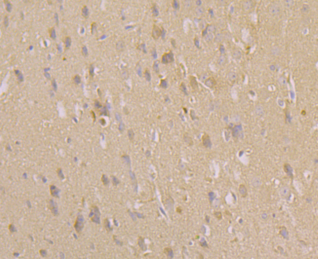 Immunohistochemical analysis of paraffin-embedded mouse brain tissue using anti-CACNB1 antibody. Counter stained with hematoxylin.