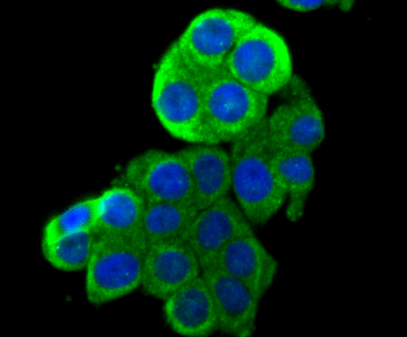 ICC staining HKDC1 in LOVO cells (green). The nuclear counter stain is DAPI (blue). Cells were fixed in paraformaldehyde, permeabilised with 0.25% Triton X100/PBS.