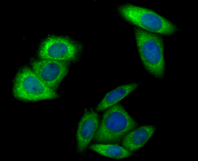 ICC staining HKDC1 in SiHa cells (green). The nuclear counter stain is DAPI (blue). Cells were fixed in paraformaldehyde, permeabilised with 0.25% Triton X100/PBS.