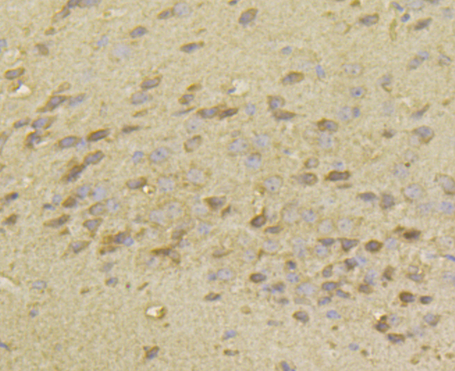 Immunohistochemical analysis of paraffin-embedded mouse brain tissue using anti-HKDC1 antibody. Counter stained with hematoxylin.