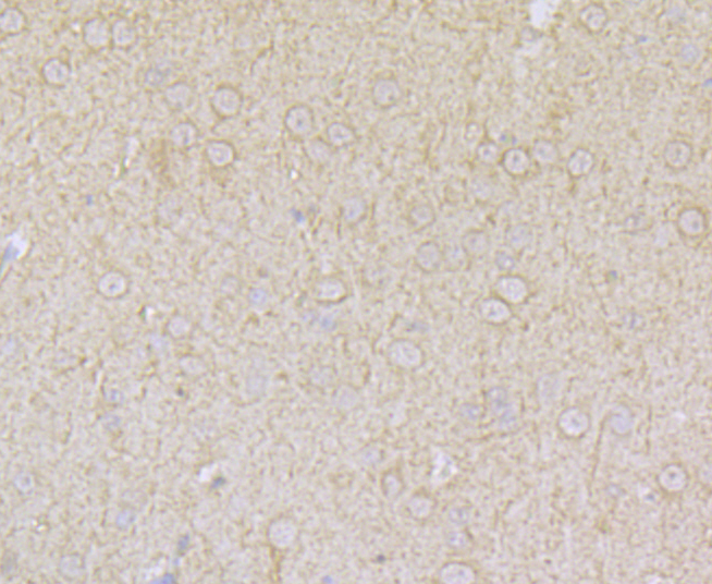 Immunohistochemical analysis of paraffin-embedded rat brain tissue using anti-ACCN2 antibody. Counter stained with hematoxylin.