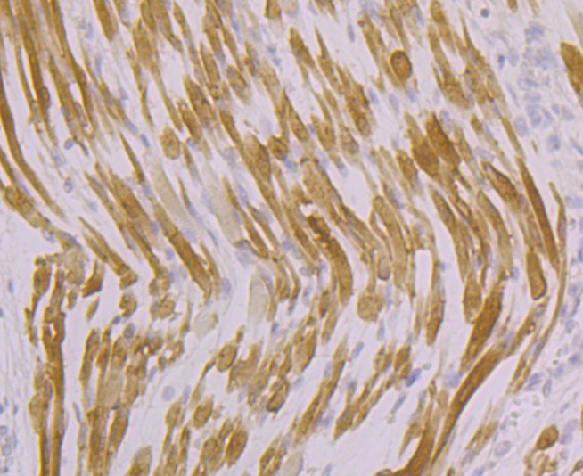 Immunohistochemical analysis of paraffin-embedded human fetal skeletal muscle tissue using anti-ATP2A1 antibody. Counter stained with hematoxylin.