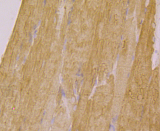 Immunohistochemical analysis of paraffin-embedded mouse skeletal muscle tissue using anti-ATP2A1 antibody. Counter stained with hematoxylin.