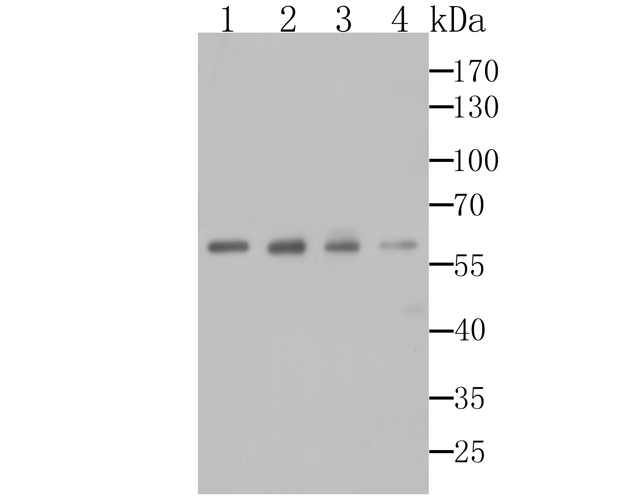 Western blot analysis of AMBP on different cell lysates using anti-AMBP antibody at 1/1,000 dilution.<br />
  Positive control:<br />
  Lane 1: HepG2<br />
               Lane 2: Human liver<br />
  Lane 3: Mouse liver<br />
         Lane 4: Mouse brain