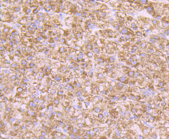 Immunohistochemical analysis of paraffin-embedded human liver tissue using anti-AMBP antibody. Counter stained with hematoxylin.