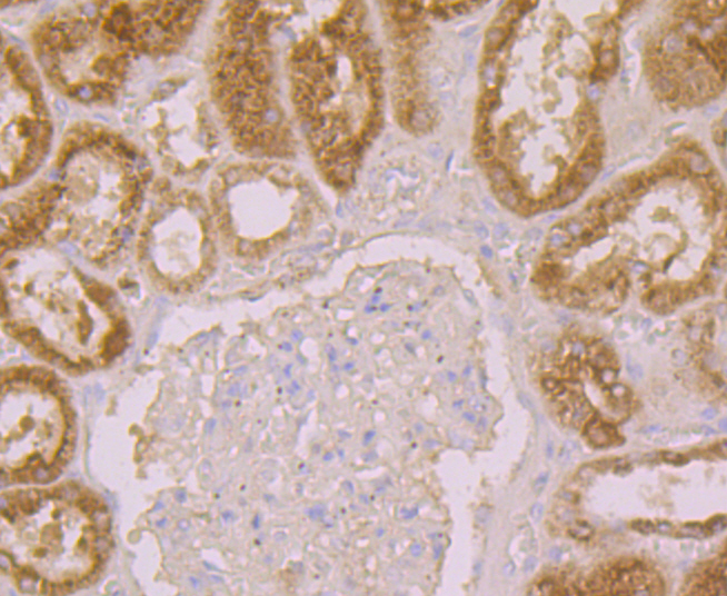 Immunohistochemical analysis of paraffin-embedded human kidney tissue using anti-AMBP antibody. Counter stained with hematoxylin.