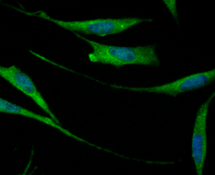 ICC staining CD276 in SH-SY-5Y cells (green). The nuclear counter stain is DAPI (blue). Cells were fixed in paraformaldehyde, permeabilised with 0.25% Triton X100/PBS.