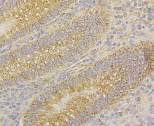 Immunohistochemical analysis of paraffin-embedded human appendix tissue using anti-CD276 antibody. Counter stained with hematoxylin.