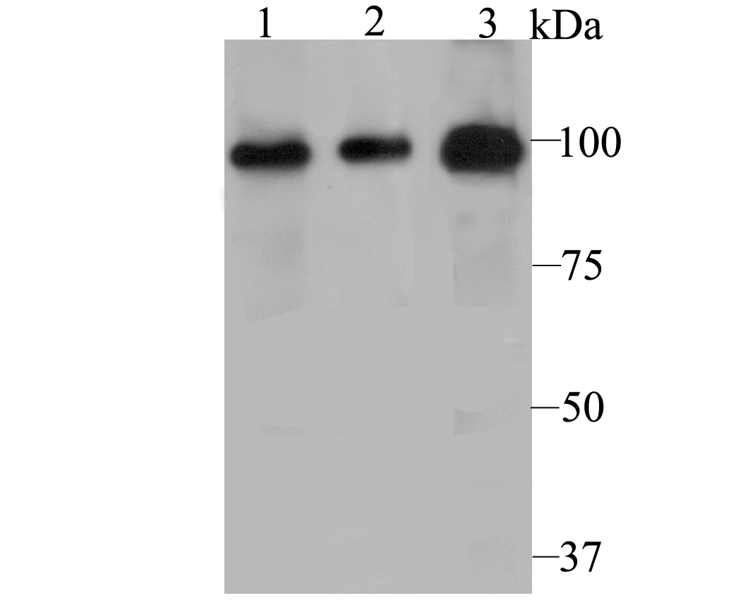 Western blot analysis of PHF8 on different cell lysate using anti-PHF8 antibody at 1/500 dilution.<br />
  Positive control:<br />
  Lane 1: PC-3M<br />
  Lane 2: A431<br />
  Lane 3: Human kidney tissue