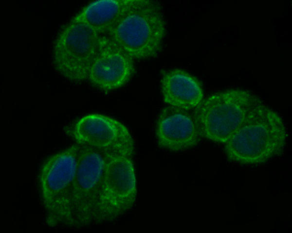 ICC staining PHF8 in Hela cells (green). The nuclear counter stain is DAPI (blue). Cells were fixed in paraformaldehyde, permeabilised with 0.25% Triton X100/PBS.