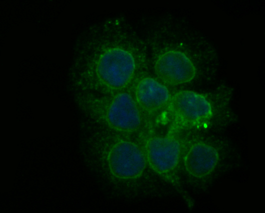 ICC staining PHF8 in JAR cells (green). The nuclear counter stain is DAPI (blue). Cells were fixed in paraformaldehyde, permeabilised with 0.25% Triton X100/PBS.